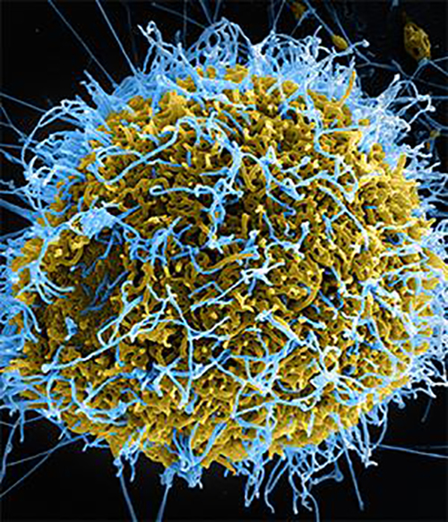 A new test developed at Washington University School of Medicine in St. Louis can detect virtually any virus that infects people and animals, including the Ebola virus (above). [Courtesy of The National Institute of Allergy and Infectious Diseases]