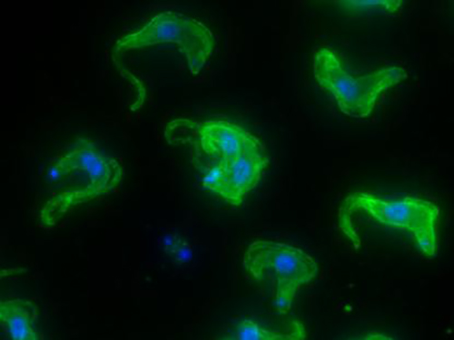 Trypanosomes are able to flourish in the bloodstream by continually changing their protein coat. The inhibition of bromodomains causes the protein coat to stick, shown in green, giving the host immune system enough time to recognize and eliminate the parasite. [Laboratory of Lymphocyte Biology at The Rockefeller University]