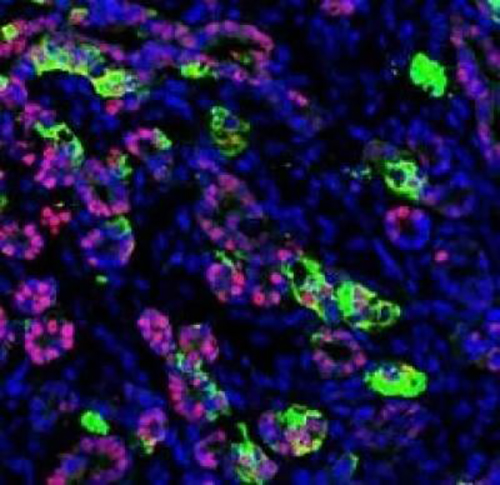 Functioning human pancreatic cells after they've been transplanted into a mouse. [Saiyong Zhu]