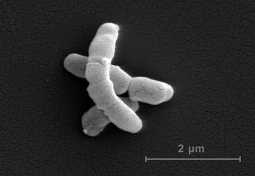 An electron microscopy image of <i>Propionibacterium acnes</i>. [Matthias Mörgelin/Lund University]” /><br />
<span class=
