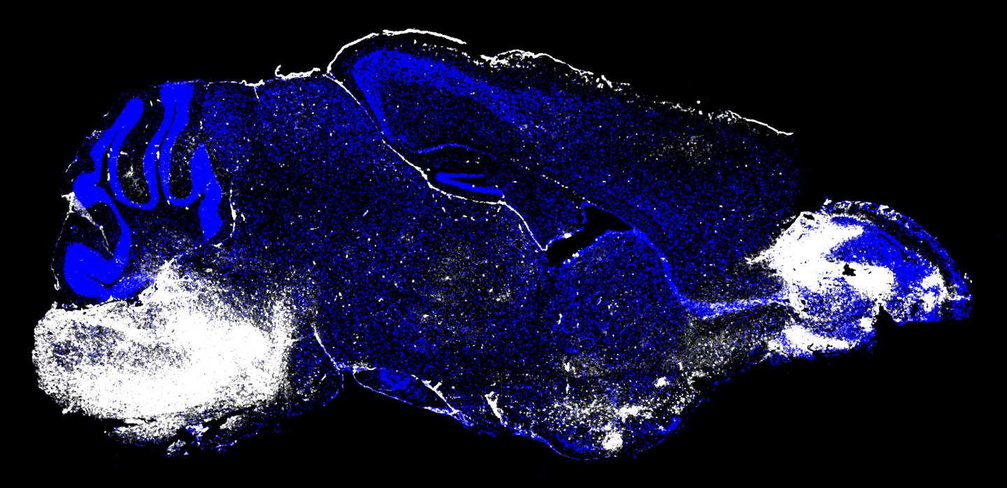 This image shows the brain of a mouse with cerebral malaria. White regions (left, brainstem and right, olfactory bulb) indicate areas of neuronal cell death and vascular leakage. [Image courtesy of Dorian McGavern, Ph.D., and Phillip Swanson II, Ph.D./NIH]