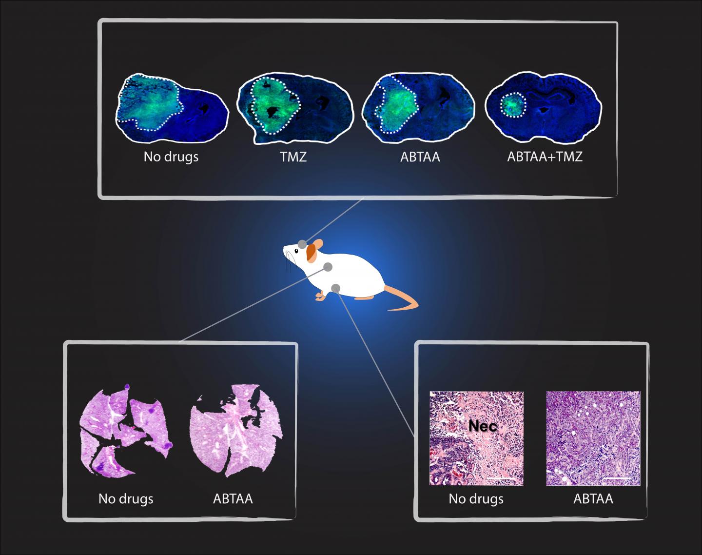 The antibody ABTAA alone and in combination with other anticancer drugs has a beneficial effect in reducing tumor volume. ABTAA was tested in mice with brain tumor (glioma) and lung or breast cancer. The image shows the improvements: reduction in glioma tumor size, reduction in metastatic colonies in lung tumor, and decrease in necrotic regions in breast tumor. [Institute for Basic Science ]