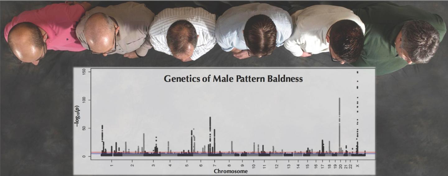 Genetics of male pattern baldness are shown. [Douglas Robertson/University of Edinburgh Centre for Cognitive Ageing and Cognitive Epidemiology]