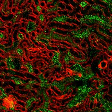 Renal tissue from laser scanning confocal microscopy, with coloration of the cytoskeleton (red fluorescence) and acetylated proteins (green fluorescence). [Egor Plotnikov]