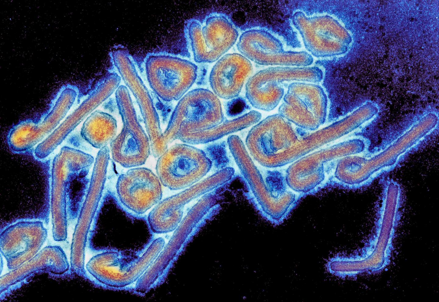 Micrograph of the Marburg virus. [The University of Texas Medical Branch at Galveston]