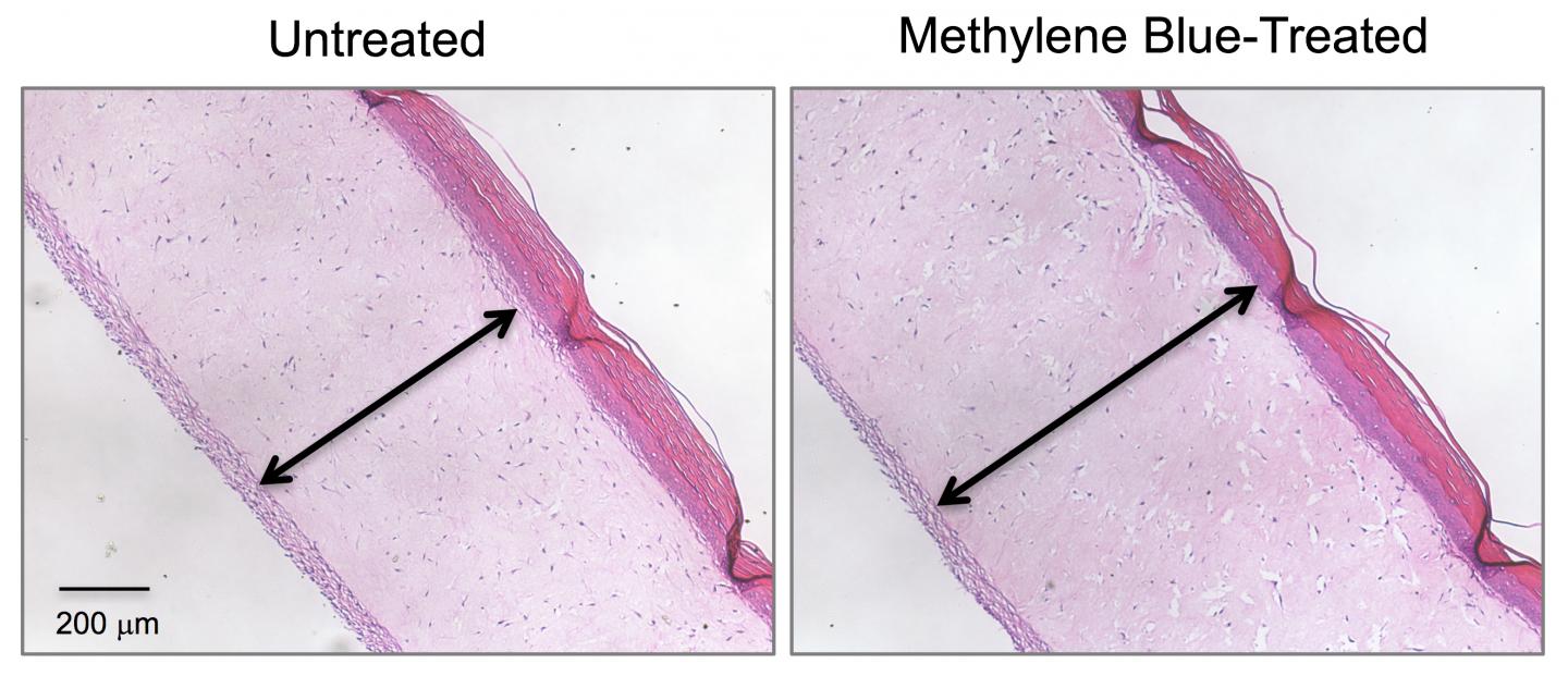 These cross-section images show three-dimensional human skin models made of living skin cells. Untreated model skin (left panel) shows a thinner dermis layer (black arrow) compared with model skin treated with the antioxidant methylene blue (right panel). [Zheng-Mei Xiong/University of Maryland]