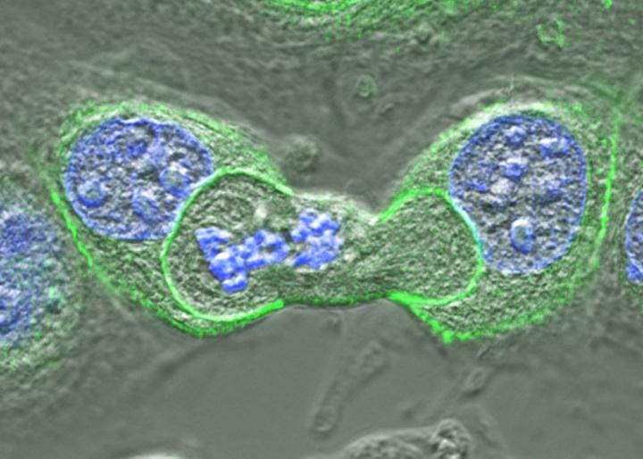 A cell in the process of dividing (center) that is being engulfed by cells on either side. DNA is shown in blue and a protein responsible for attachment between cells is shown in green. [Dr. Jo Durgan/Babraham Institute]