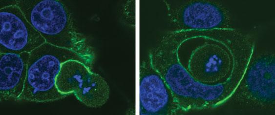 (Left) A dividing cell (lower right) in the process of being engulfed by another cell (center). (Right) A dividing cell that has been completely consumed by another cell. DNA shown in blue. A protein involved in contact between cells shown in green. [Dr. Jo Durgan/Babraham Institute]