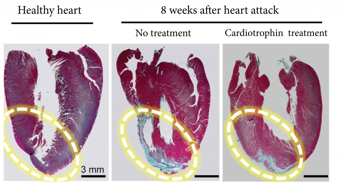 The far right image shows how a cardiotrophin treatment repaired heart muscle after a heart attack in a rat model. The blue areas are scar tissue and the red sections are healthy heart muscle. [Cell Research]