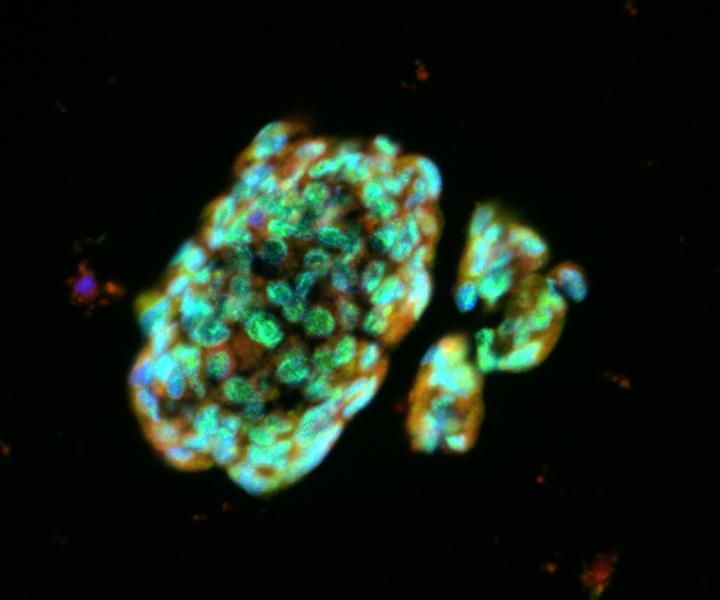 These lung spheroid cells showed powerful regenerative properties when applied to a mouse model of lung fibrosis. [NCSU and UNCSM]