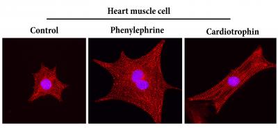 Cardiotrophin 1 stimulates a good kind of heart muscle growth, generating long healthy fibers (right panel). Heart disease causes an unhealthy kind of heart muscle growth, similar to what is seen with phenylephrine treatment (middle panel). [Cell Research]