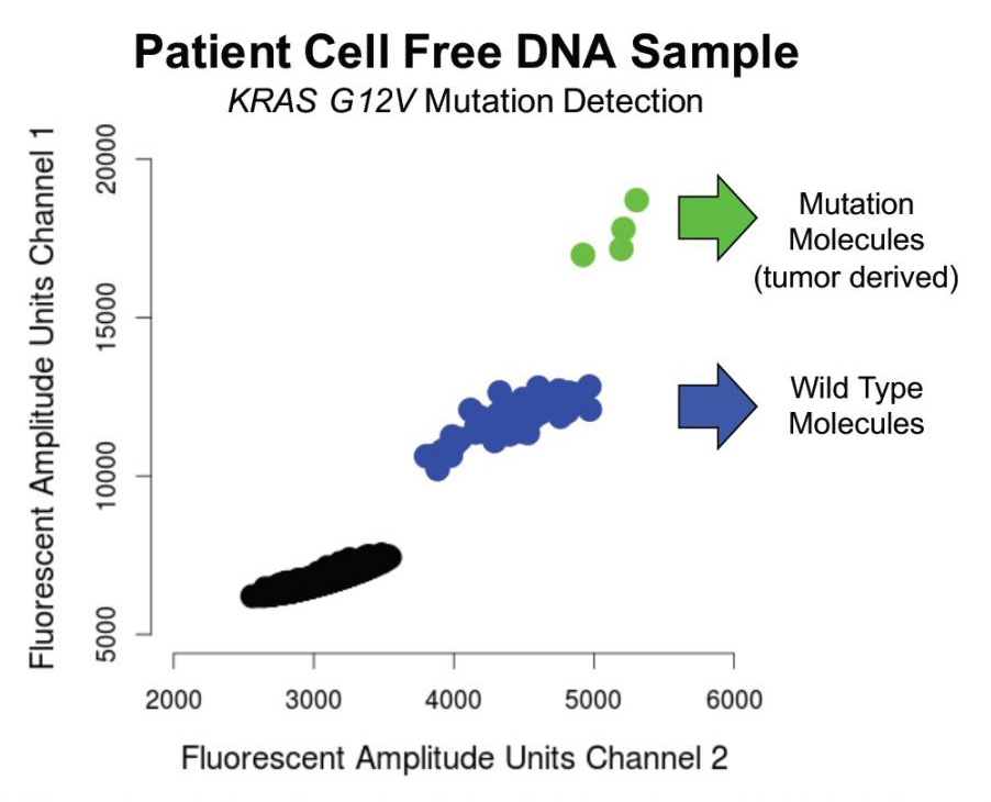 This figure illustrates how the assay can be used clinically. In this patient, the data enabled the investigators to count the number of DNA molecules containing the KRAS G12V mutation and, therefore, count the number of molecules that came from the patient's tumor. The green dots represent molecules found to contain the mutation sequence, and the blue dots represent wild-type normal DNA molecules. The information was derived from less than a nanogram of cell-free DNA. [Hanlee P. Ji/Stanford Genome Technology Center]