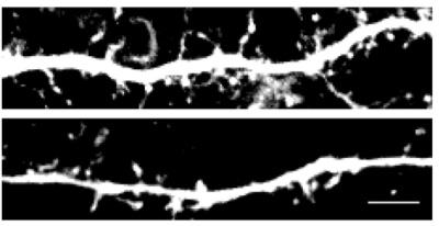 Nerve cells lacking fragile X mental retardation protein have too many dendritic spines, small signal-receiving spindles coming off the main tendril (top). But treatment with a drug called JQ1 reduces the number of spines (bottom). Scale bar, 10 µm. [Korb et al./Cell 2017]