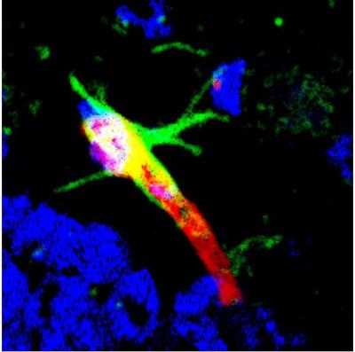 This image shows DAG (green-labeled peptide) targeting to the brain blood vessel (labeled red) in the hippocampus of the Alzheimer's brain. [Ruoslahti Lab, SBP]