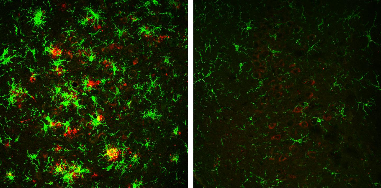 The brain of a 10-month-old mouse with Alzheimer's disease (left) is full of amyloid plaques (red) surrounded by activated microglial cells (green). But these hallmarks of Alzheimer's disease are reversed in animals that have gradually lost the BACE1 enzyme (right). [Hu et al., 2018]