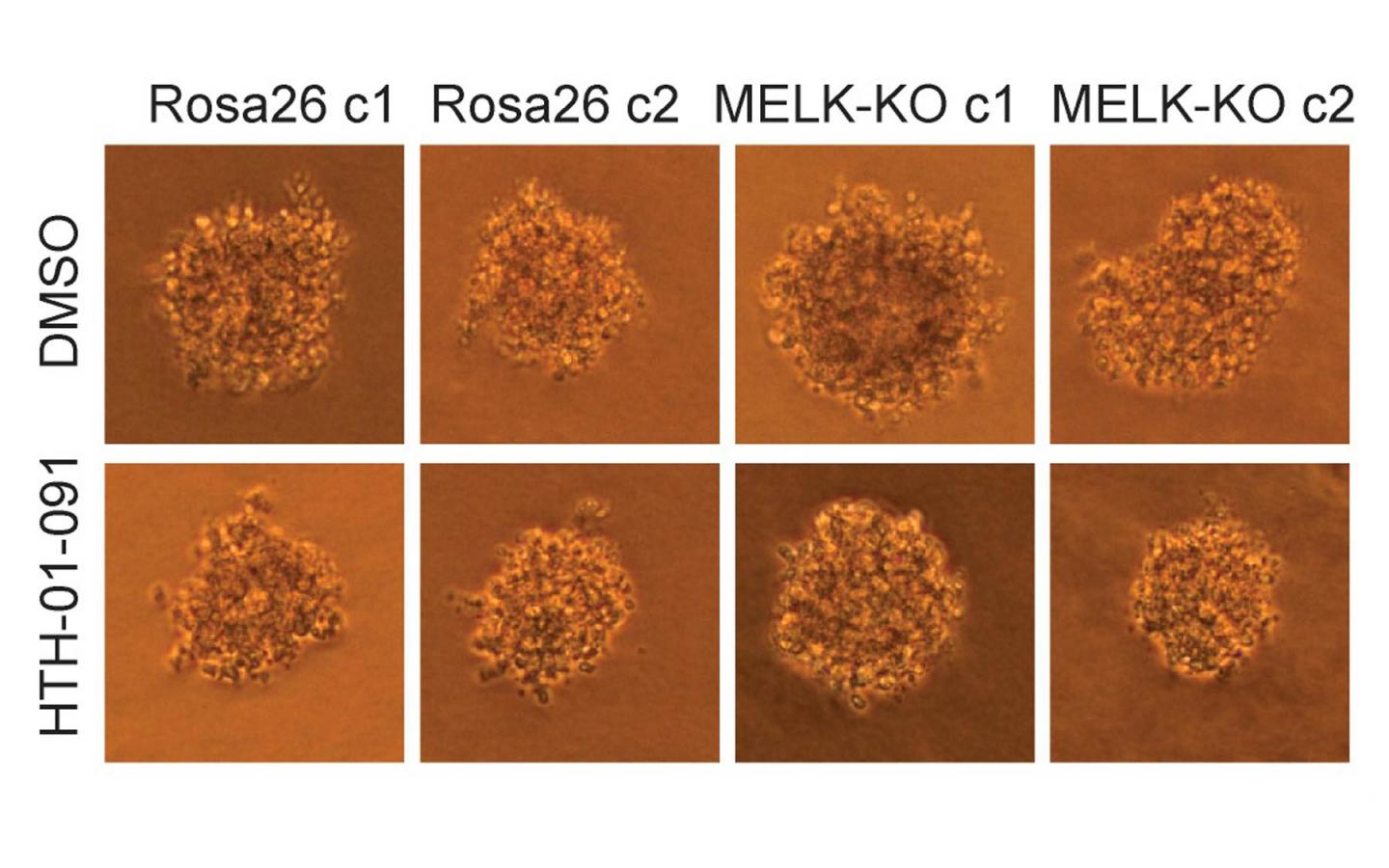 The growth of human colon cancer cells (raised in culture) is unaffected by the MELK gene. Top row: untreated cells; bottom row: cells treated with a MELK inhibitor drug. Left two columns, control cells; right two columns, cells in which MELK gene has been knocked out. CSHL researchers conclude that MELK is not involved in cancer proliferation. [Sheltzer Lab, CSHL]