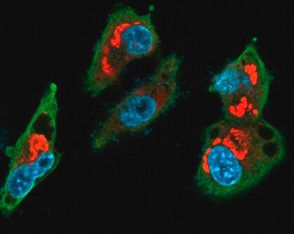 Human medulloblastoma cells infected by Zika (red). [HUG-CELL]