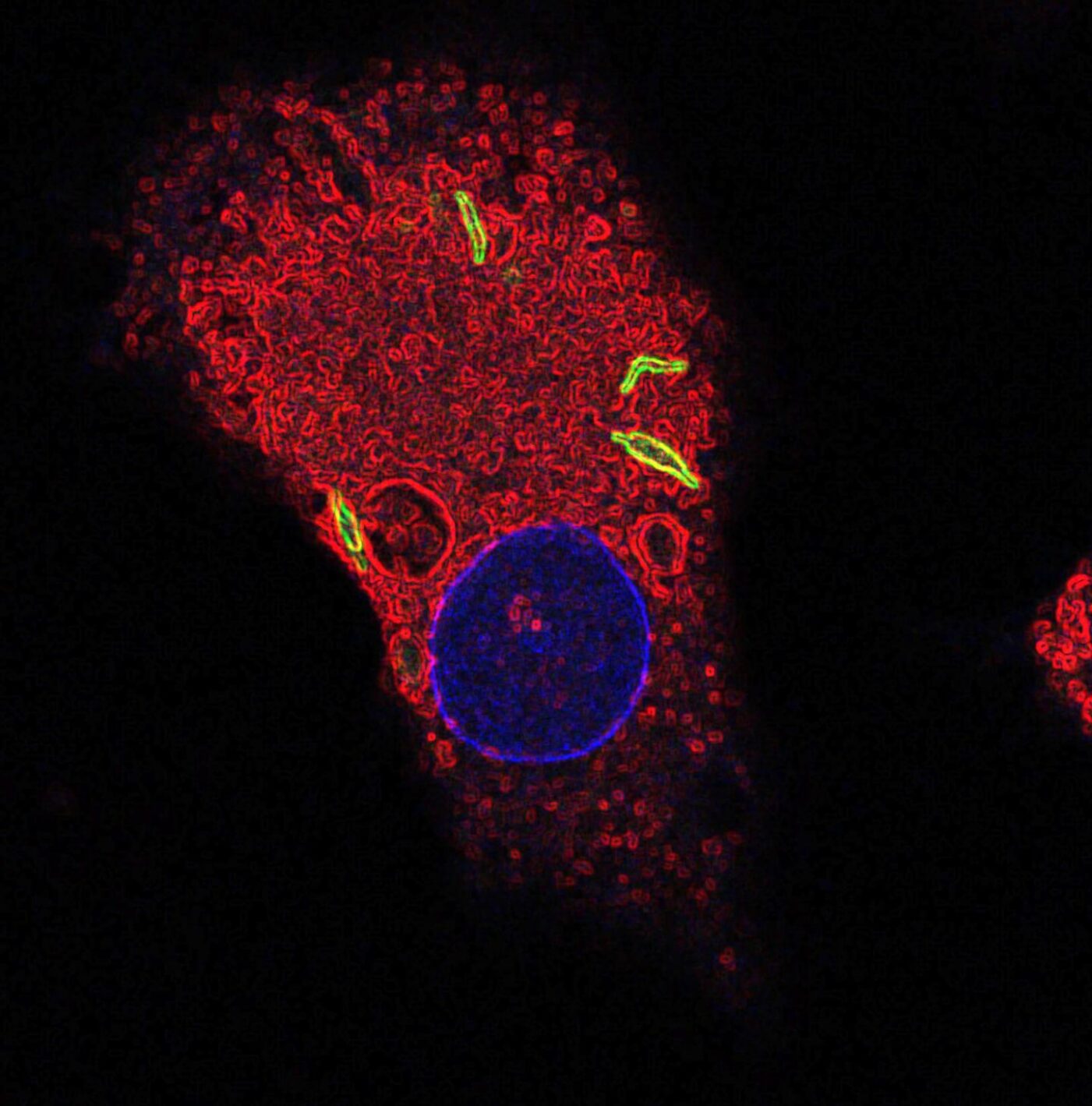Image of a macrophage labeled for the nucleus (blue), fused lysosomes and phagosomes (red), and TB bacteria (green). [Susanne Herbst/Francis Crick Institute]