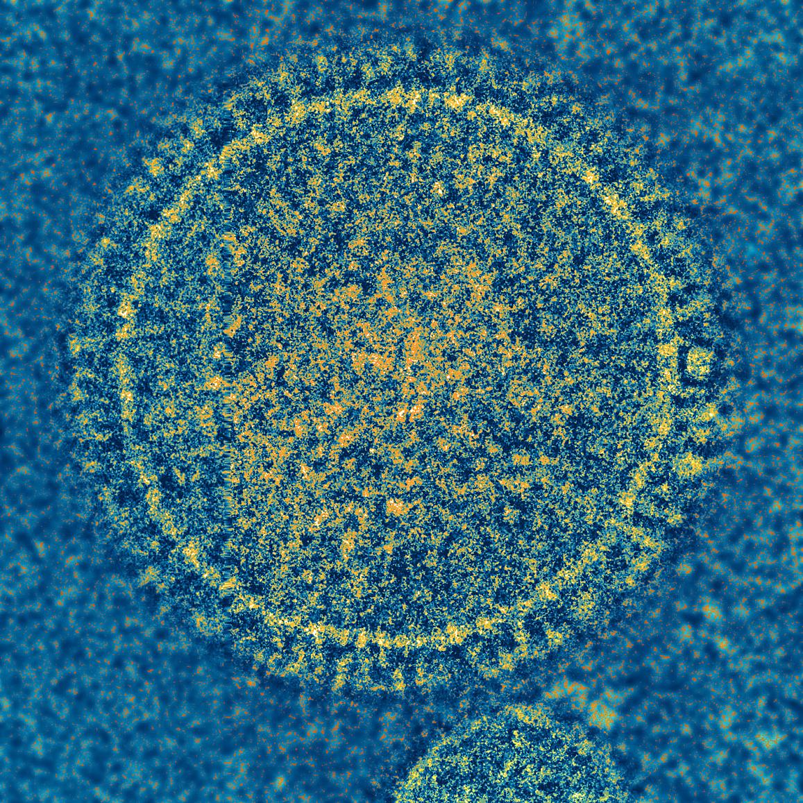 The respiratory syncytial virus (RSV) is responsible for a common childhood illness. Researchers are hopeful that results from this new study will provide a model for developing an effective human RSV vaccine. [NIH]