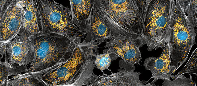 In this photograph of cow cells, the mitochondria were stained in bright yellow to visualize them in the cell. The large blue dots are the cell nuclei and the gray web is the cytoskeleton of the cells. [NIH]