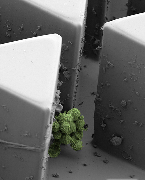 Scanning electron micrograph of a circulating tumor cell cluster captured by Cluster-Chip. [Sarioglu et al., Nature Methods]