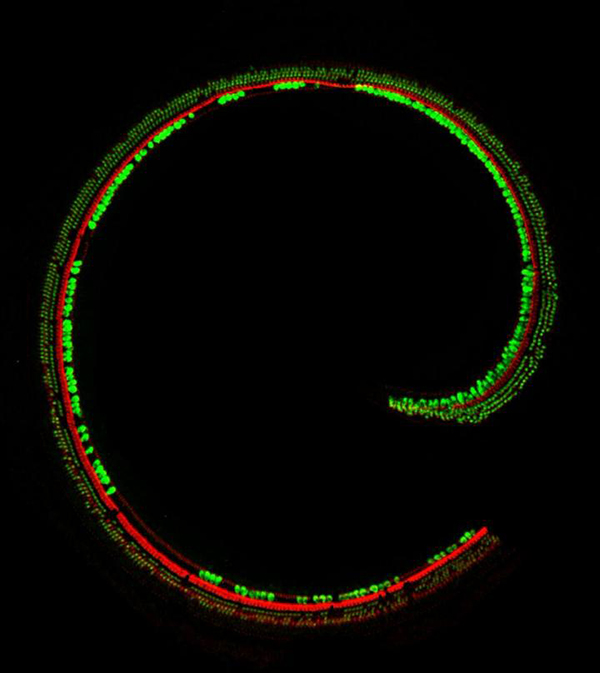 Sensory hair cells in the cochlea of a Beethoven mouse treated with TMC2 gene therapy. In this confocal microscopy image, microvilli are shown in red and cell bodies in green. The human ear has about 16,000 sensory hair cells. [Charles Askew]