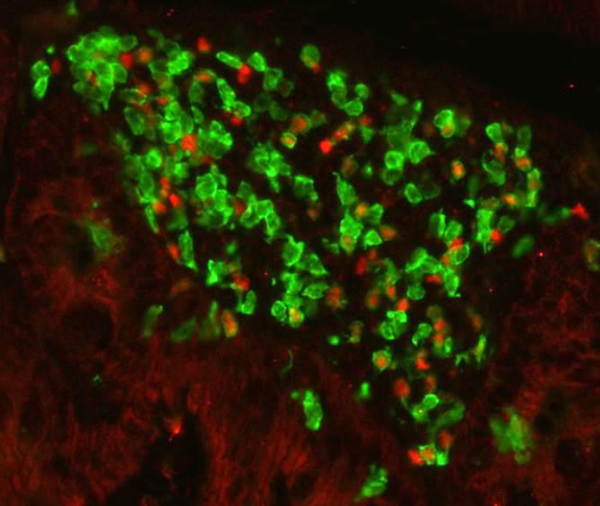 A cluster of type 3 cells (shown in green) in a mouse colon. These cells are induced by the microbiota and block type 2 allergic reactions. [Institut Pasteur]