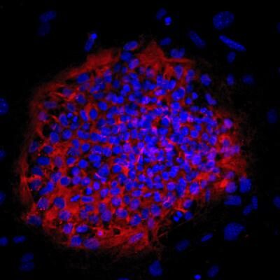 A colony of haploid embryonic stem cells created at the Hebrew University's Azrieli Center for Stem Cells and Genetic Research. [Hebrew University of Jerusalem]