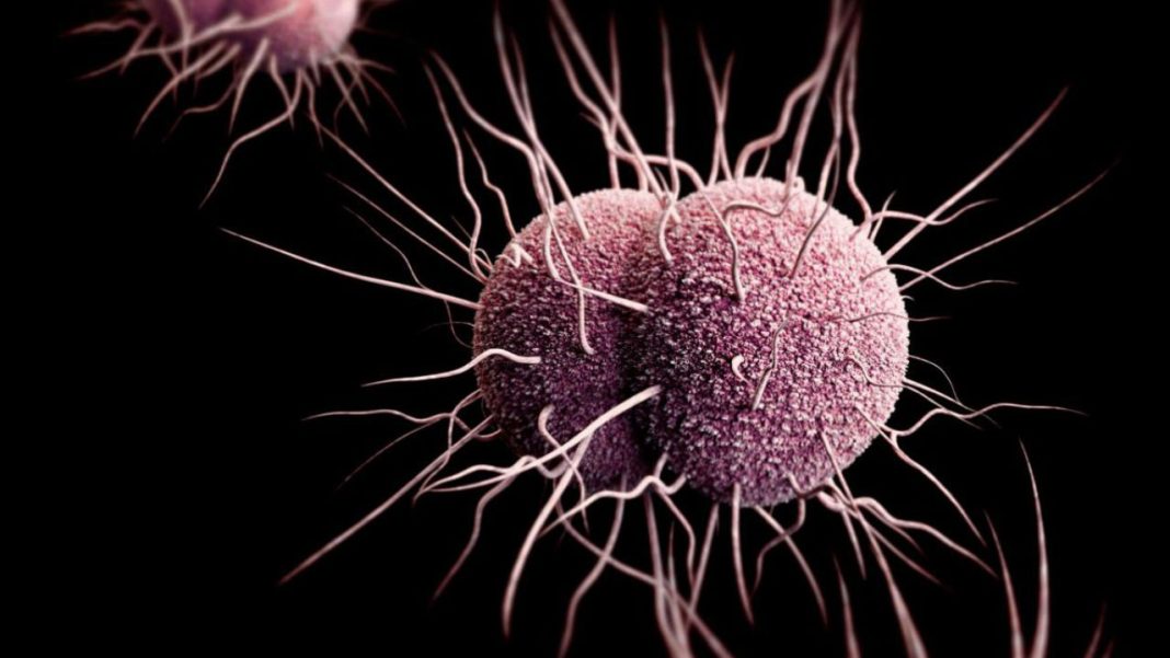 Gonorrhea Superbug Evades Immune System By Creating Vesicles That ...