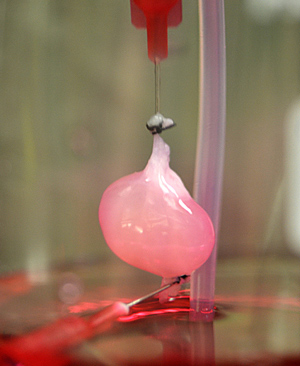 Previously decellularized rat kidney after reseeding with endothelial cells, to repopulate the organ's vascular system, and neonatal kidney cells. [Ott Laboratory, Massachusetts General Hospital Center for Regenerative Medicine]