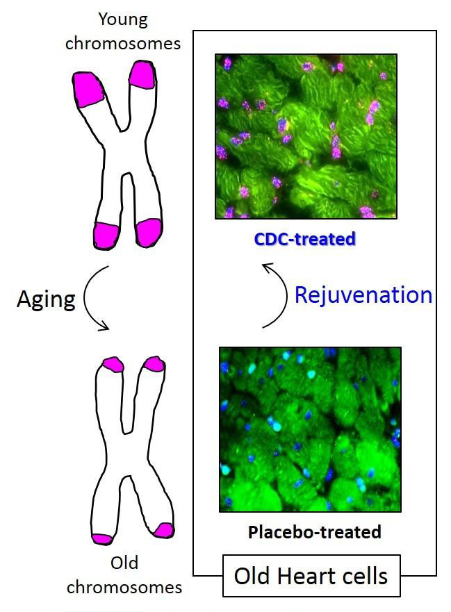 Telomeres, stained in purple, are caps that protect our chromosomes from damage. They get shorter with aging and are enlarged with young CDCs in the study. [Cedars-Sinai]