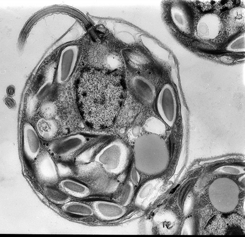 The algae <i>Chlamydomonas reinhardtii</i>, shown here in a transmission electron micrograph, has been found to contain a light-activated system that can remove interrupting sequences from protein. [Mary Morphew and J. Richard McIntosh/Cell Image Library]” /><br />
<span class=