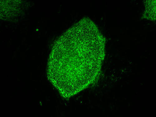 This image shows induced pluripotent stem cells expressing a characteristic cell-surface protein called stage-specific embryonic antigen-4 (SSEA4) (green). [Stephen A. Duncan, Ph.D./Medical University of South Carolina]