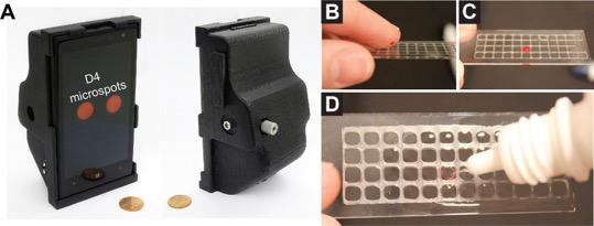 (A) The 3D printed smartphone attachment that uses the phone's camera to review the results of the assay. (B–D) The process to administer a blood sample onto the D4 assay. [Daniel Joh/Duke University]