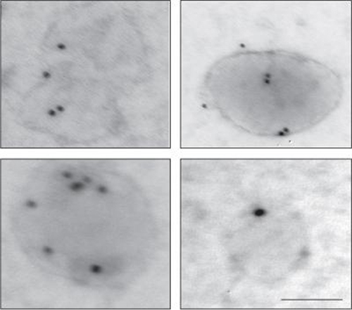 Micrographs of newly described membranes vesicles that induce autoantibody production and accelerate rejection are shown. [Université de Montréal, CRCHUM]