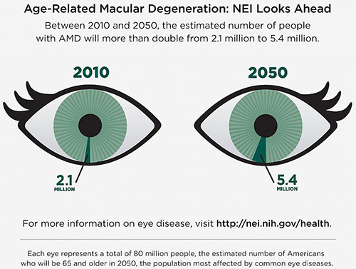 Between 2010 and 2050, the number of people in the United States with age-related macular degeneration is expected to more than double. [National Eye Institute]