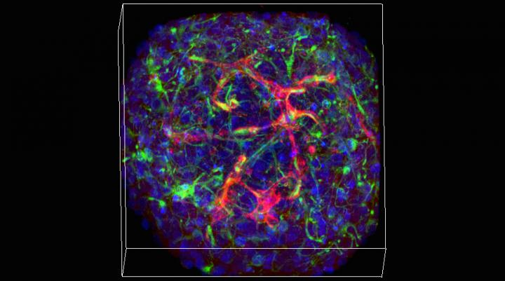 Under the microscope, staining highlights a network of vasculature amid the ball of neurons that make up a minibrain. [Hoffman-Kim Lab/Brown University]
