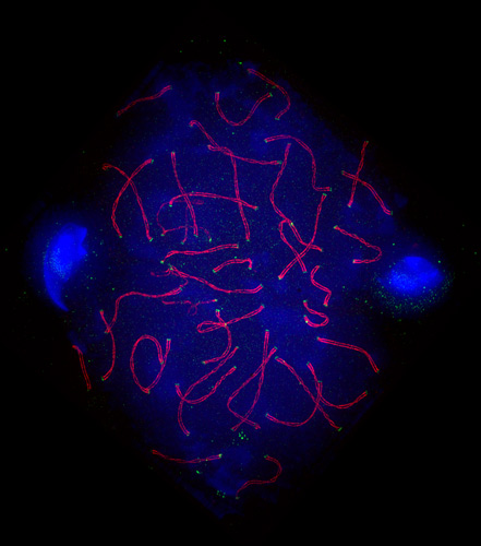 Graham Wright from the Institute of Medical Biology, A*STAR, in Singapore was a regional winner in the microscopy category for this image: Mouse spermatocyte spread stained for KASH-5 and SCP3 (red and green) and DNA (blue). Therapeutic focus: Fertility.