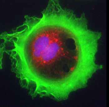 Martin Barr of St James’ Hospital and Trinity College Dublin won first place in the High-Content Analysis category for this image: Lung adenocarcinoma cell stained for F-actin (green), mitochondria (red) and DNA (blue). Therapeutic focus: Cancer.