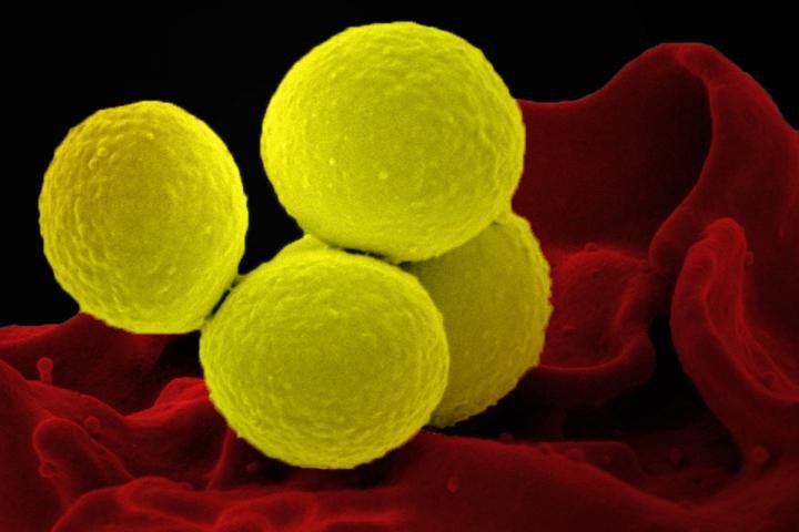 <i>Staphylococcus aureus</i> bacteria is linked to up to 50,000 deaths each year in the U.S.  [NIAID]” /><br />
<span class=