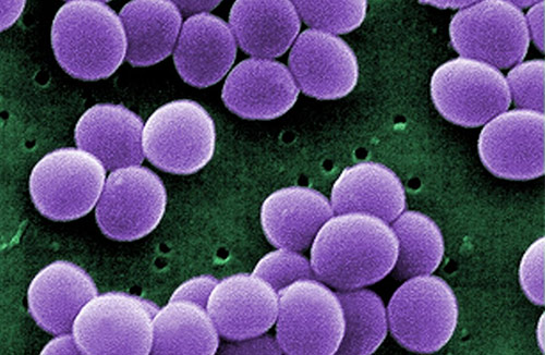 <i>Staphylococcus aureus</i> bacteria [CDC/DRPH]” /><br />
<span class=