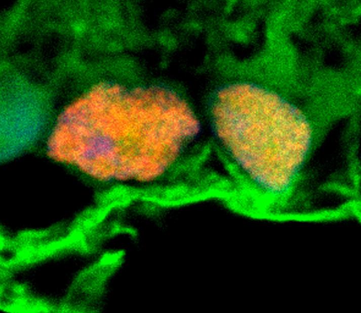 Microscopy image shows exosomes (green) surrounding retinal ganglion cells (orange and yellow). These exosomes, which had been isolated from stem cells, were shown to convey miRNAs to the retinal ganglion cells. These miRNAs appear to have a protective effect in a model of glaucoma. [Ben Mead, Ph.D/National Eye Institute, NIH]