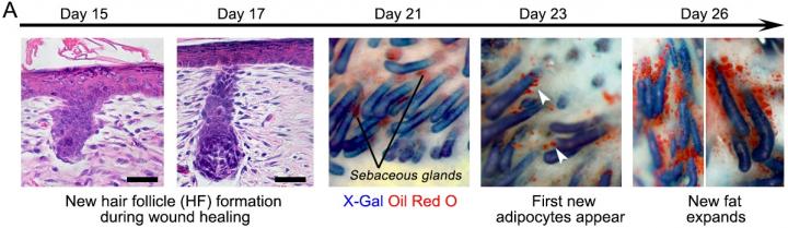 The progression of the wound during healing when hair follicles are present. [Penn Medicine]