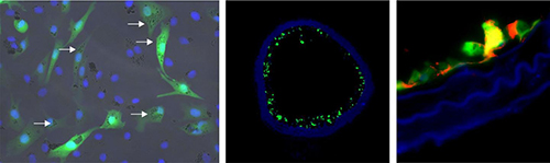 On the left are fluorescence-labeled cells with nanoparticles: The cellular nuclei are shown in blue, the fluorescence labeling is shown in green, and the nanoparticles in the cells are identified by arrows. The middle photo shows a blood vessel populated with these cells (green). On the right is a detailed image of a vascular wall with the eNOS protein identified (red). [Dr. Sarah Rieck/Dr. Sarah Vosen, Univ of Bonn]