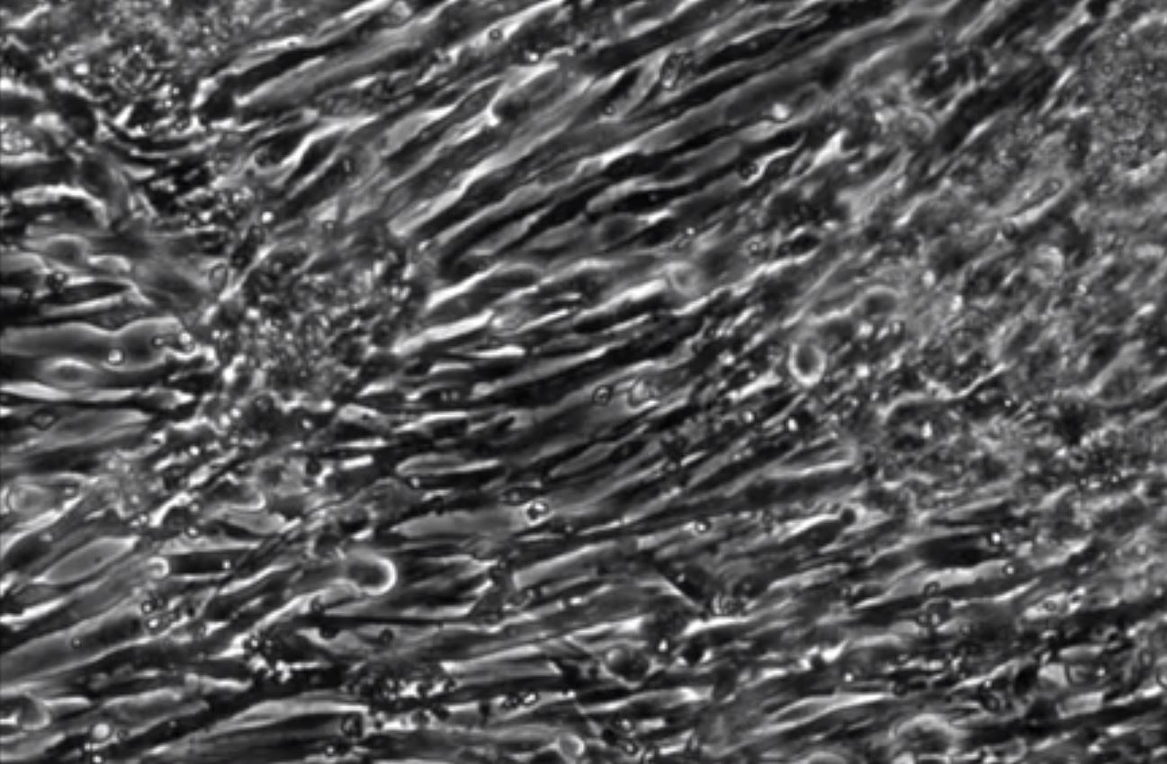 Researchers have grown the first functioning human muscle tissue from skin cells reprogrammed into stem cells. [Duke University]