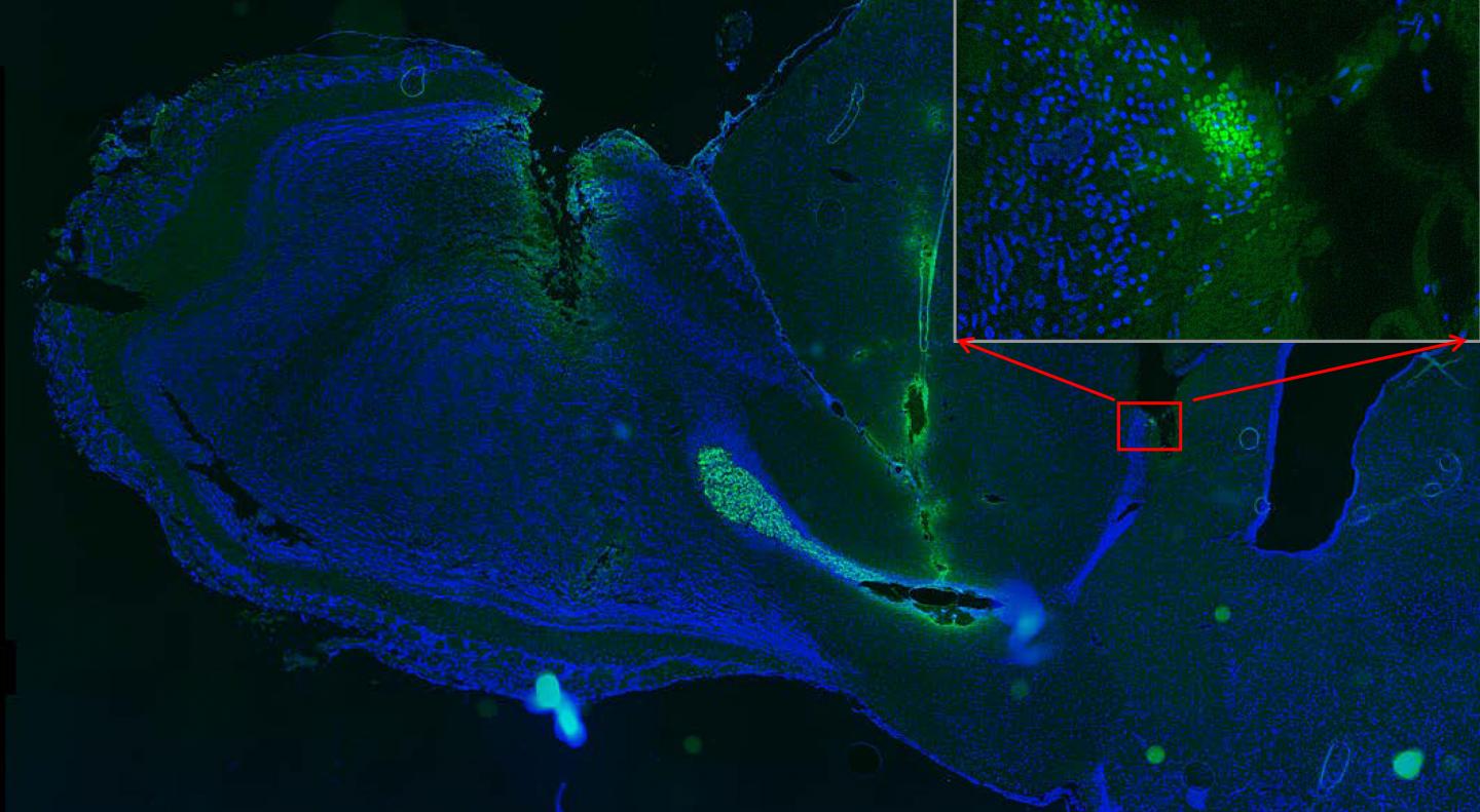 Transplants of neural stem cells might be used to treat brain injuries, but how to get them to the right location? UC Davis researcher Min Zhao and Junfeng Feng, a neurosurgeon at Ren Ji Hospital, Shanghai, showed that they can steer transplanted stem cells (green, in inset on right) to one part of a rat's brain using electrical fields. [Junfeng Feng]