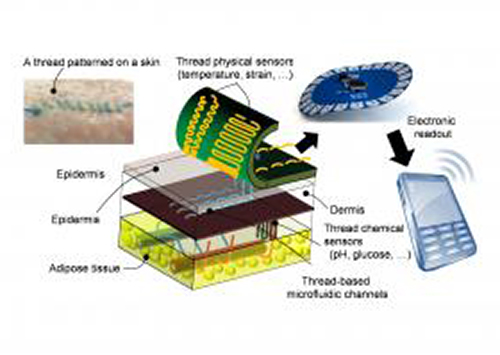 Threads penetrate multiple layers of tissue to sample interstitial fluid and direct it to sensing threads that collect data, such as pH and glucose levels. Conductive threads then deliver the data to a flexible wireless transmitter sitting on top of the skin. The inset figure, upper left, shows liquid flowing in threads sutured into skin. [Nano Lab/Tufts University]
