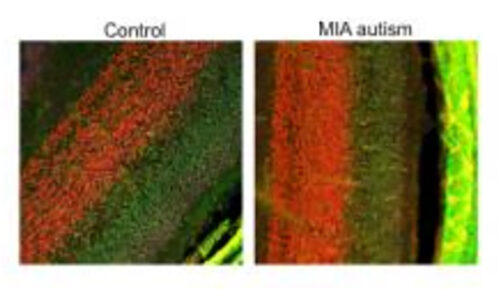 Altered neurodevelopment in a mouse model of autism. New research from the University of Virginia School of Medicine reveals that the health of the microbiome during pregnancy determines autism risk. The microbiome is the collection of microscopic organisms that naturally live inside us. [John Lukens Lab, Univ. of Virginia School of Medicine Dept. of Neuroscience]