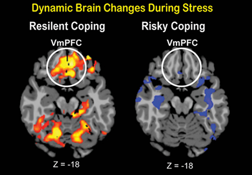 Flexible neural responses were shown in an area of the brain called the ventral medial prefrontal cortex (VmPFC) during sustained stress exposure. [Yale]