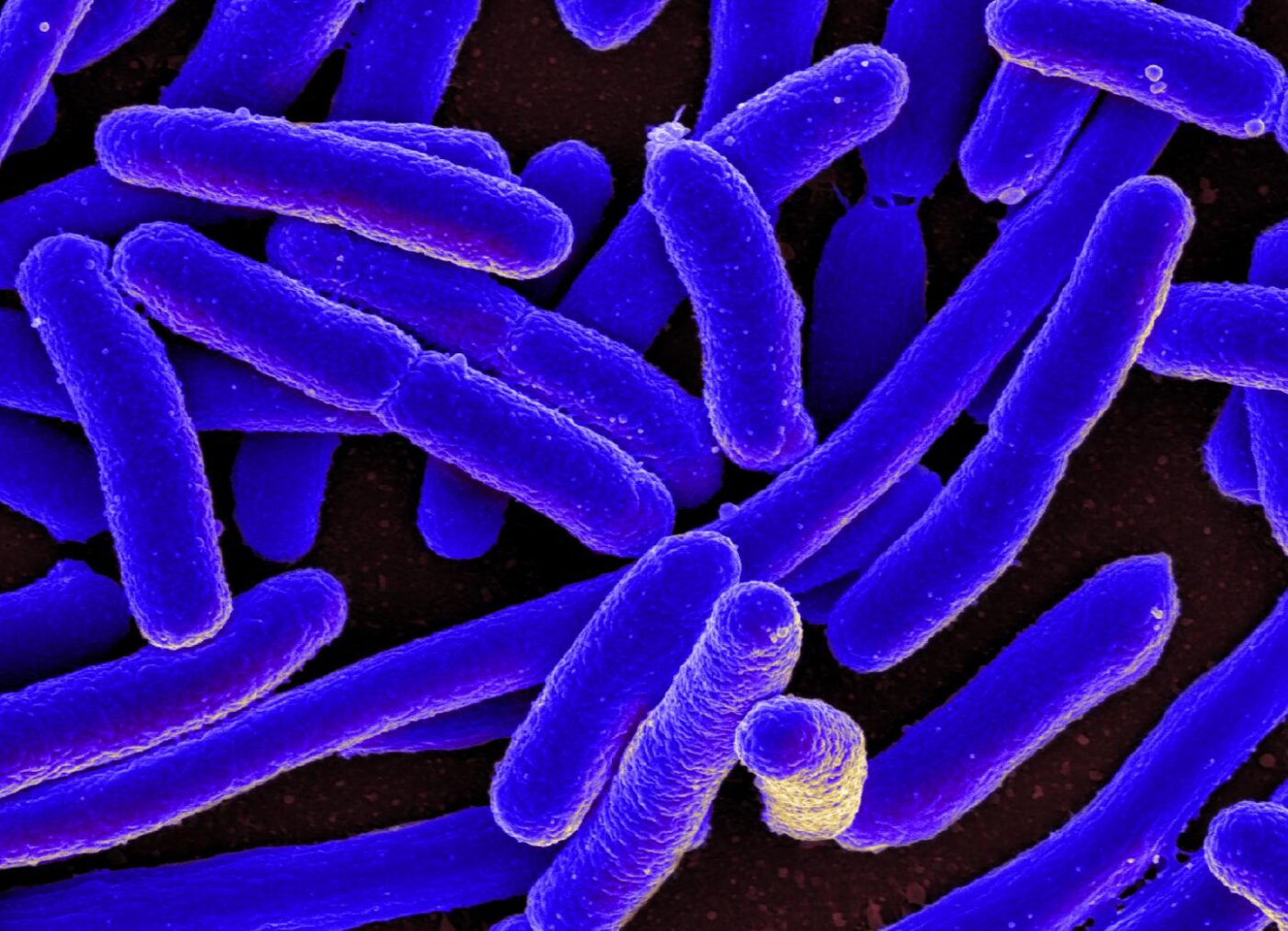 E. coli bacteria was used to study the sequences in DNA where the risk for mutation is significantly elevated. [National Institute of Allergy and Infectious Diseases]